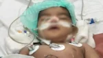 Rare Infant Liver Transplant Saves 18-Month-Old | Mother and Baby Matters