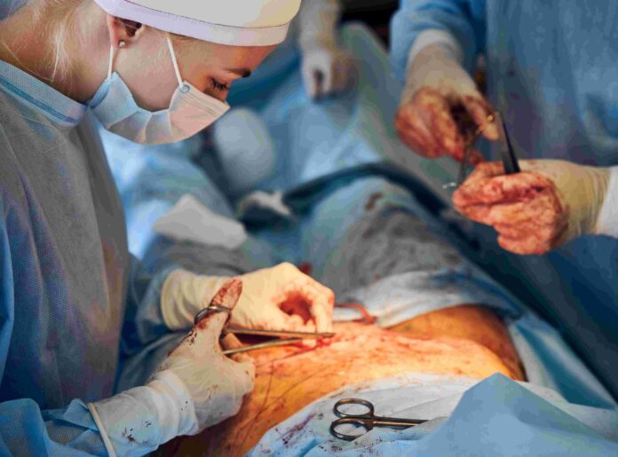 doctor-assistant-stitching-up-wound-after-abdominoplasty-surgery