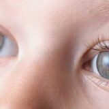 Cataract