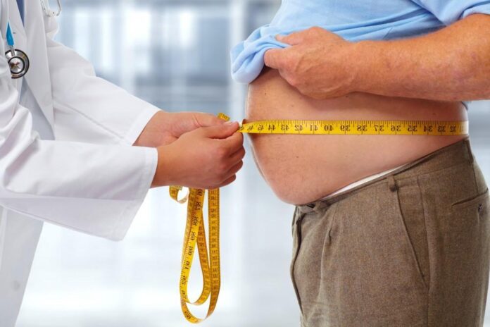 obesity Obesity
