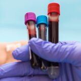 Blood test