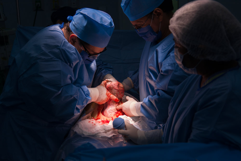 Cesarean section