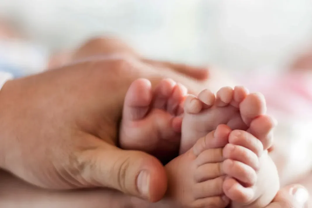 Conjoined Twins - Mother and Baby Matters