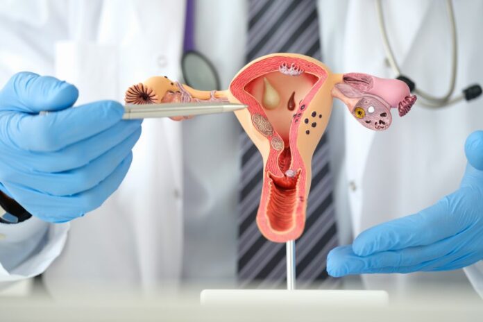 Uterine-Cancer-Treatment-Chicagoland--1024x683 Surviving Uterine Cancer