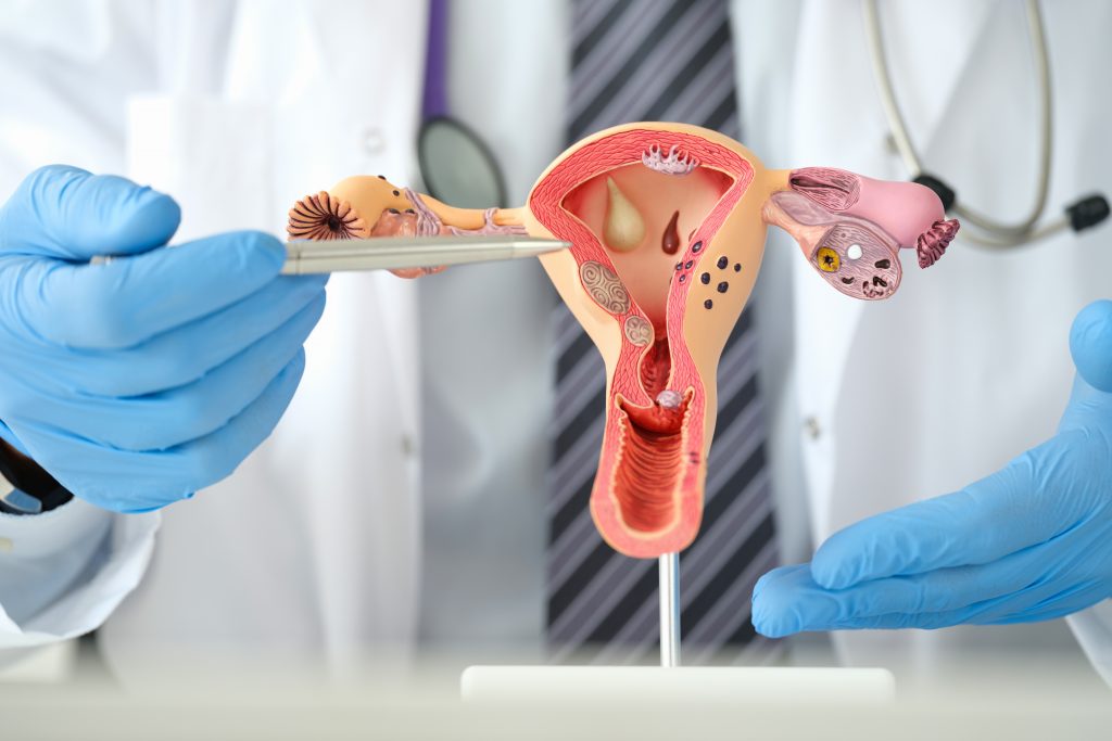 Surviving Uterine Cancer