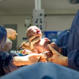 C-Section - Mother and Baby Matters
