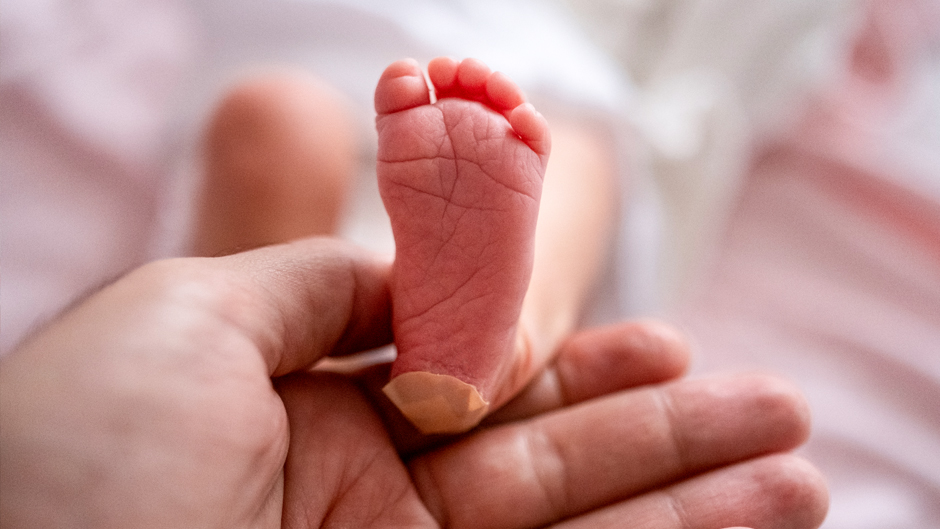 Premature Baby